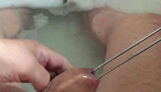 Foreskin in bath 20 minutes